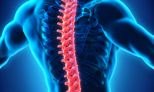 Spine Imaging