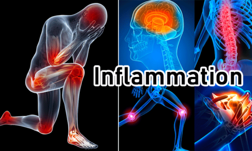 Inflammatory and infectious diseases